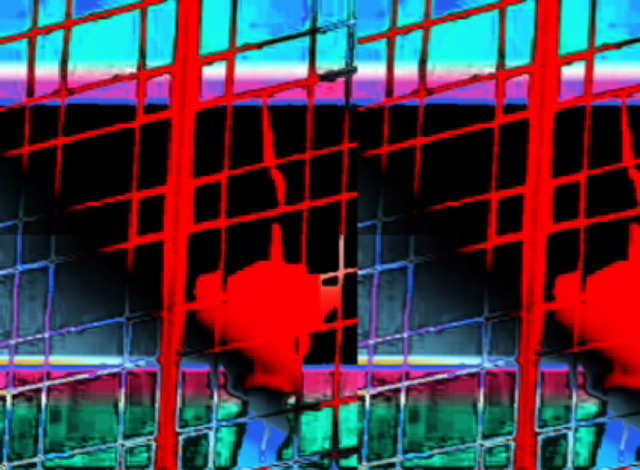 Loading Image