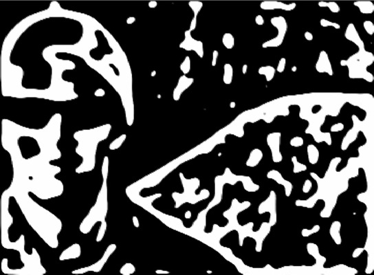 Loading Image